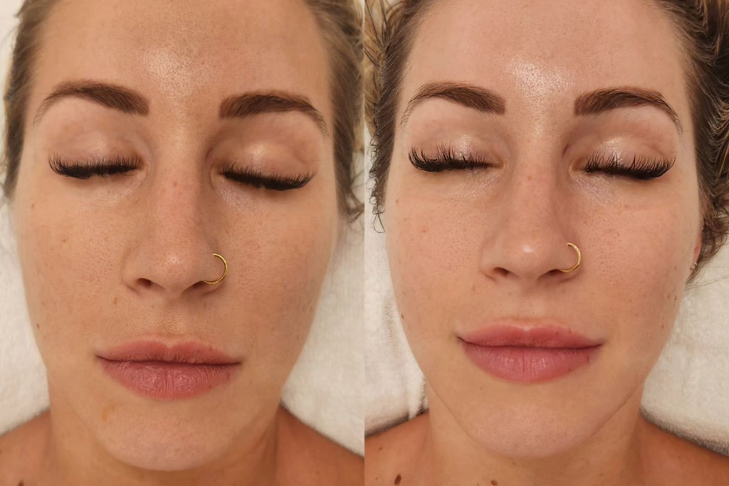 A Closer Look at Buccal Massage: A Holistic Approach to Facial Muscle Relaxation