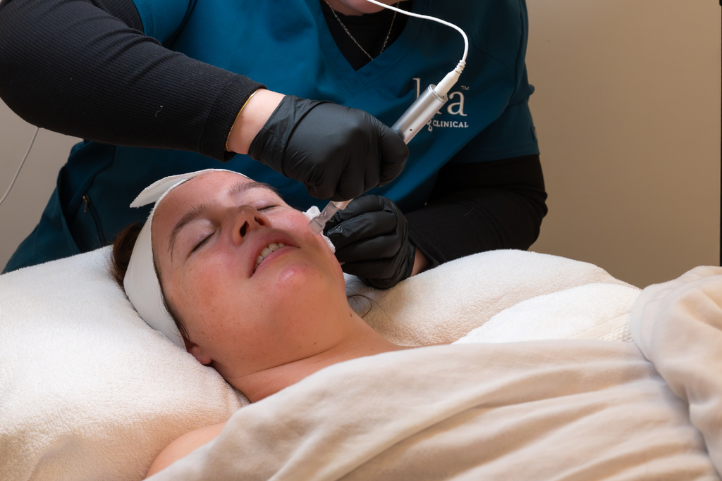 Skin Needling with Exosomes: A More Advanced Approach to Skin Repair